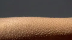 Neurobiologiskt fenomen: varför får vi gåshud?